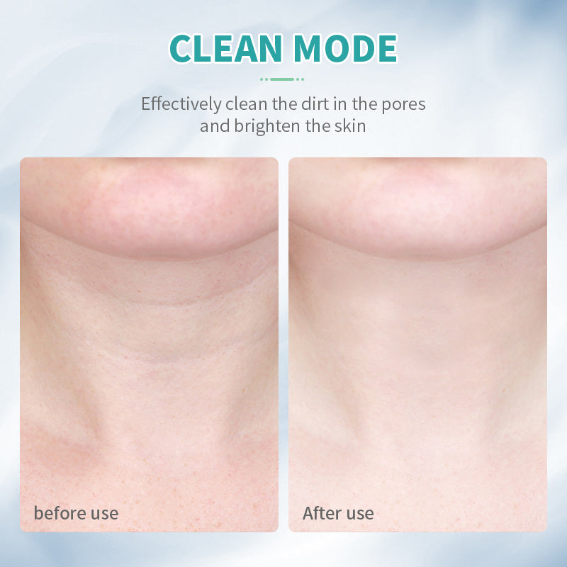 ANLAN EMS Facial & Neck Lifting Device – 3 Colors Light Therapy for Skin Tightening, Double Chin Reduction, and Ultimate Skincare